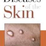 Diseases of the Skin their Constitutional Nature & Homeopathic Cure: paper back by J. Compton Burnett