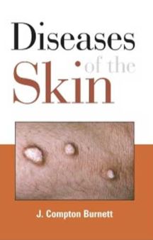 Diseases of the Skin their Constitutional Nature & Homeopathic Cure: paper back by J. Compton Burnett