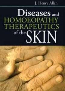 Diseases & Homeopathy Therapeutics of Skin By J H ALLEN